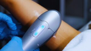 Ameliyatsız Yüz Germe Nedir? Kimler İçin Uygundur, Faydaları Nelerdir?